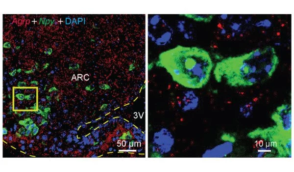 Researchers pinpoint brain cells that drive appetite in obesity