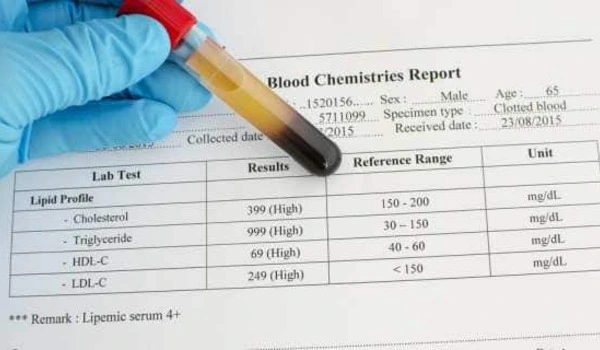Simple blood test may predict future heart, kidney risk for people with Type 2 diabetes